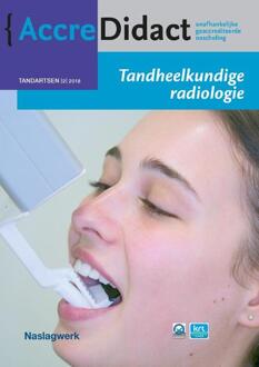 Tandheelkundige radiologie - Boek Paul van der Stelt (9089762868)