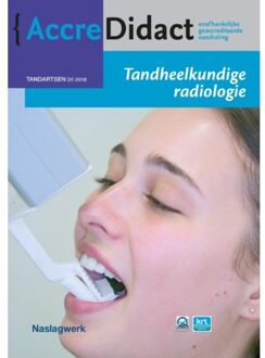 Tandheelkundige radiologie - Boek Paul van der Stelt (9089762868)