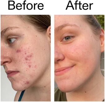 The INKEY List- 15% Vitamine C en EGF Serum 30 ml