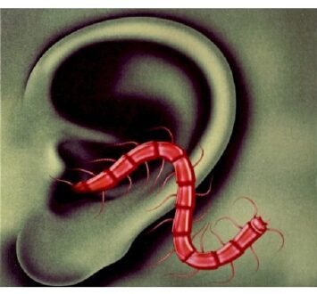 Thee Oh Sees - An Odd Entrances