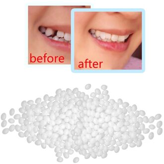 Tijdelijke Tand Vervanging Materiaal Tand Vullen Temp Vervangen Ontbrekende Prothese Adhesive Diy Tanden Reparatie Tools Siliconenkit