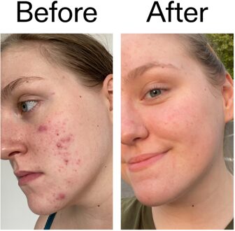 Toner met Glycolzuur 100 ml