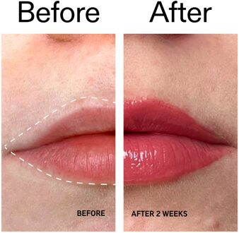 Tripeptide Plumping Lip Balm - Berry Tint