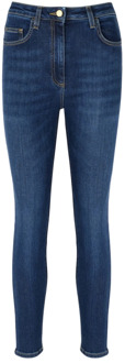 Trousers Elisabetta Franchi , Blue , Dames - W28,W31,W29,W32,W26,W30,W27