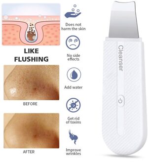 Ultrasone Huid Scrubber Facial Spatel Peeling Kawitacyjny Visage Comedondrukker Gezicht Cleaner Ultrasonico Huid Reinigen Blauw