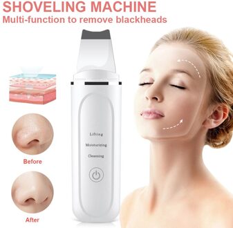 Ultrasone Huid Scrubber Trillingen Gezicht Spatel Comedondrukker Facial Scrubber Schop Schoon Cavitatie Peeling bo doos