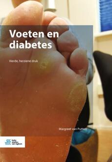 Voeten en diabetes - Boek Margreet Van Putten (9036802784)