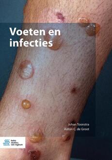 Voeten En Infecties - Johan Toonstra