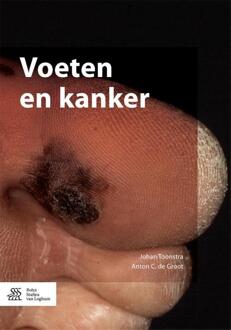 Voeten en kanker - Boek Johan Toonstra (9036810701)
