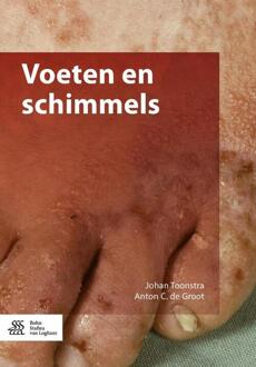 Voeten en schimmels - Boek Johan Toonstra (9036811686)