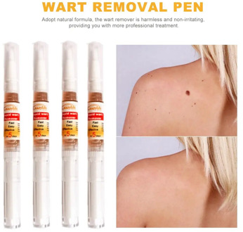 Wart Remover Skin Tag Remover Pen Genital Wart Treatment Papillomas Removal Against Moles Remover Anti Verruca Remedy
