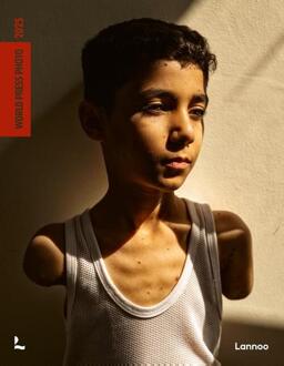World Press Photo 2025 -  World Press Photo Foundation (ISBN: 9789020970364)