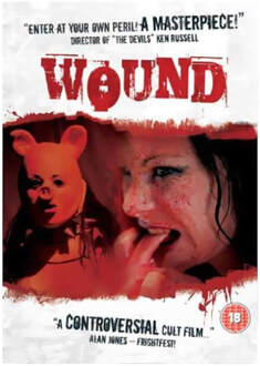 Wound