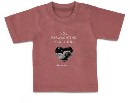 YourSurprise Baby shirt bedrukken - Korte mouw - Roze - 50/56