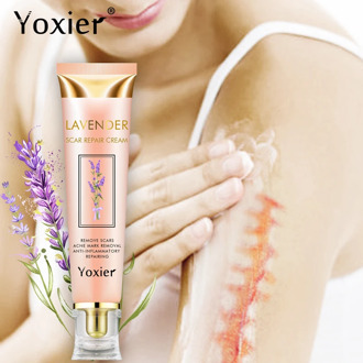 Yoxier Repair Scar Cream Acne Scar Stretch Marks Skin Care Pigmentation Corrector Anti-allergic Calm Whitening Face Cream 1pcs