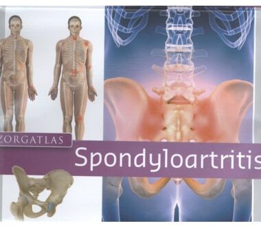 Zorgatlas Spondyloartritis + Stift - Boek I.A.A.M. van Echteld (9491984446)