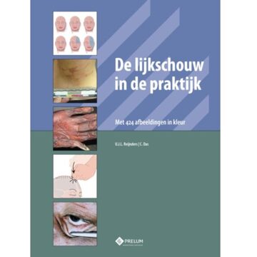 De lijkschouw in de praktijk - Boek U.J.L. Reijnders (908562150X)