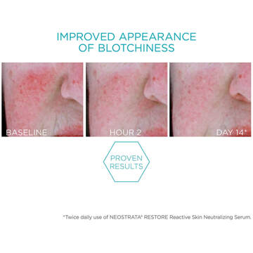 Neostrata Restore Redness Neutraliserend Serum voor de Gevoelige Huid 29g